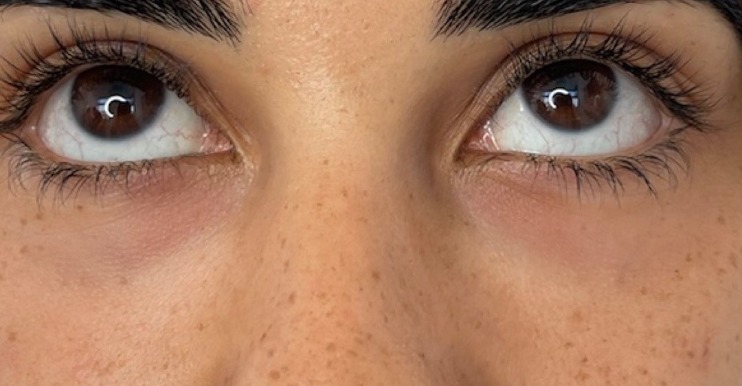 EYES2 - Copy