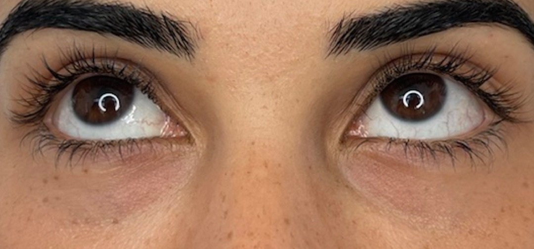 EYES2