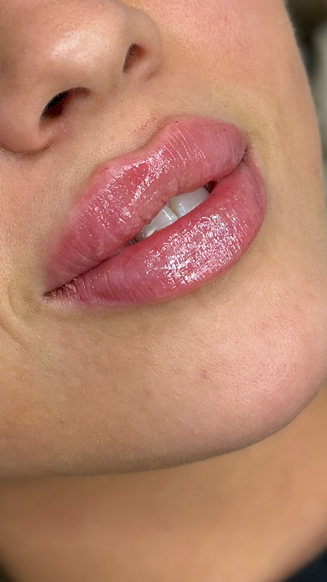 lips after story